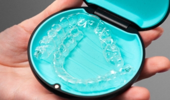 Кому подходят элайнеры?