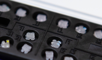 Что лучше: керамические или металлические брекеты?