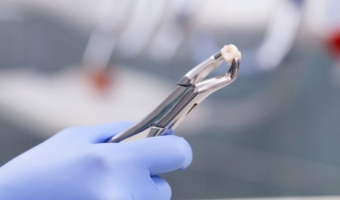 Удалять или лечить: показания к удалению зуба