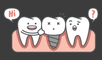 Відторгнення зубних імплантів: симптоми, причини, повторна імплантація