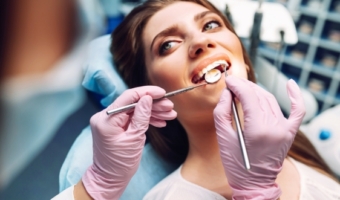 Керамические и композитные виниры: разница, показания, срок службы