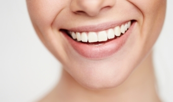 ТОП 10 мифов о лечении зубов