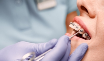 Кто такой ортодонт и что он лечит?