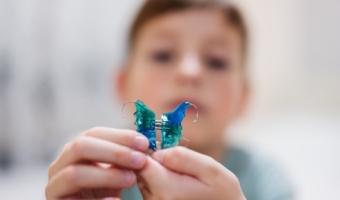 Ортодонтические аппараты для исправления прикуса