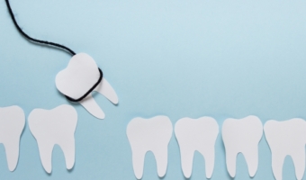 Видалення ретинованих зубів: коли потрібна операція?