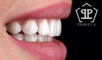 Виниры или отбеливание зубов: как сделать правильный выбор?