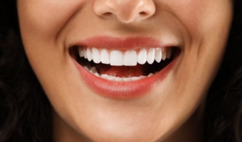 Цены на виниры: что входит в стоимость?