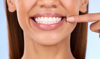 Коронки или виниры: эстетическая реставрация после коррекции прикуса