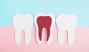 7 привычек, которые незаметно разрушают ваши зубы