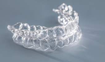 Цены на элайнеры в 2026 году – сколько стоит выровнять зубы?