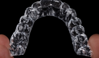 Элайнеры в РЕФЕРТА: подробный обзор и фото