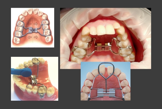 фото на сайт сео