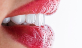 Виниры CEREC – короткий путь к идеальной улыбке