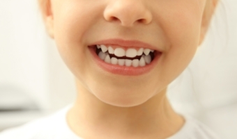 Лікування та профілактика пляшкового карієсу у дітей