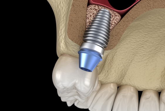 фото на сайт сео