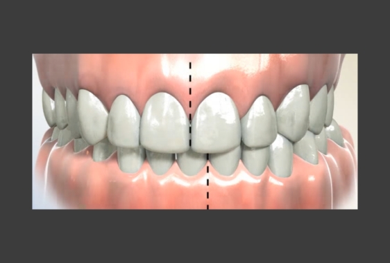 фото на сайт сео