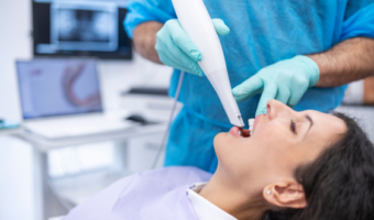 3D-сканирование челюстей вместо слепков: комфортная диагностика без ошибок