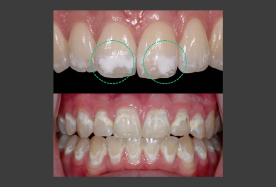 фото на сайт сео