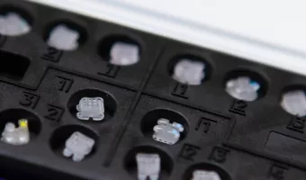 Что лучше: керамические или металлические брекеты?