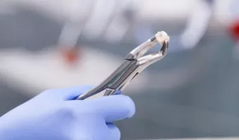 Удалять или лечить: показания к удалению зуба