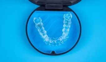 Элайнеры и виниры: цены в Киеве в 2024 году