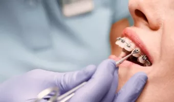 Кто такой ортодонт и что он лечит?