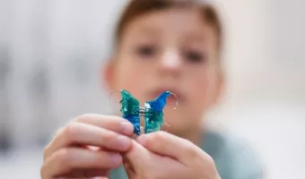 Ортодонтические аппараты для исправления прикуса