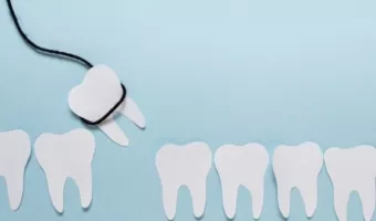 Видалення ретинованих зубів: коли потрібна операція?