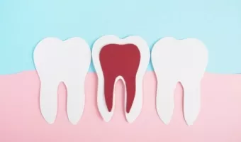 7 привычек, которые незаметно разрушают ваши зубы