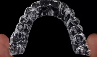 Элайнеры в РЕФЕРТА: подробный обзор и фото