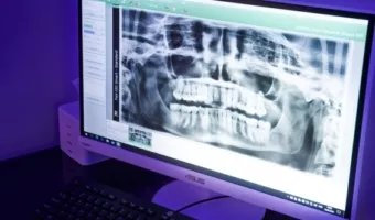 Рентген и КТ зубов: показания и специфика